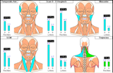 EMG study before and after wearing a FreeBite